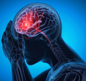 A 3D Illustration of a person holding their head signifying a brain stroke or headache.